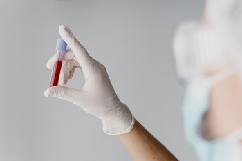 CITRE, pionero en impulsar la investigación en hematología